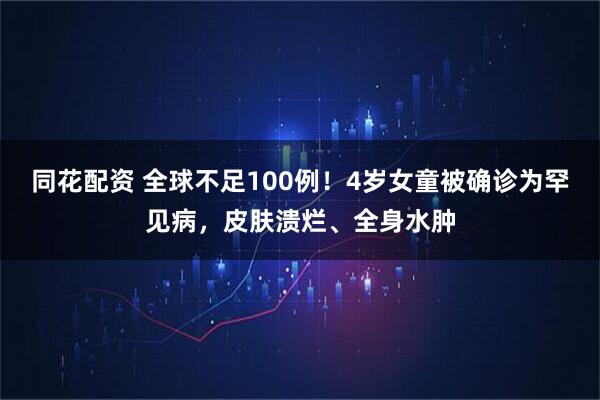 同花配资 全球不足100例！4岁女童被确诊为罕见病，皮肤溃烂、全身水肿